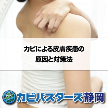 カビによる皮膚疾患の原因と対策法